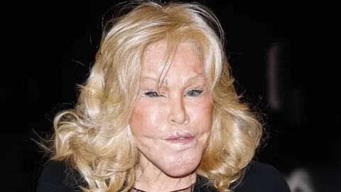 A socialite Jocelyne Wildenstein insiste que ‘nunca’ fez cir