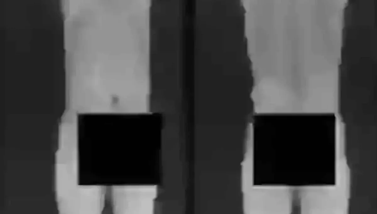 A verdade assustadora sobre o que scanners de raio‑X de aero
