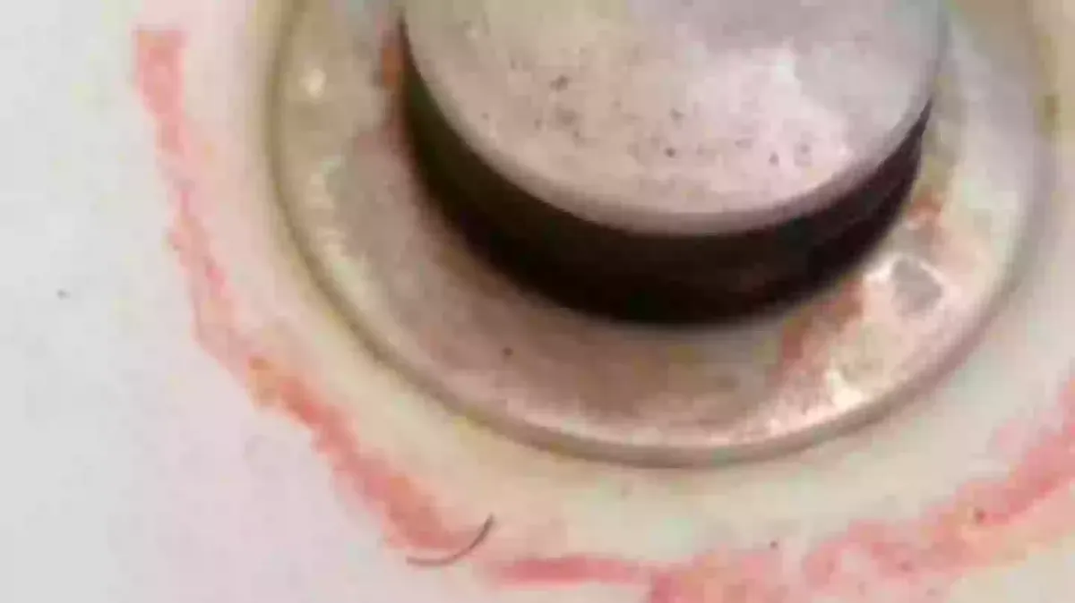 Alerta emitido para quem encontrar ‘gosma rosa’ no banheiro