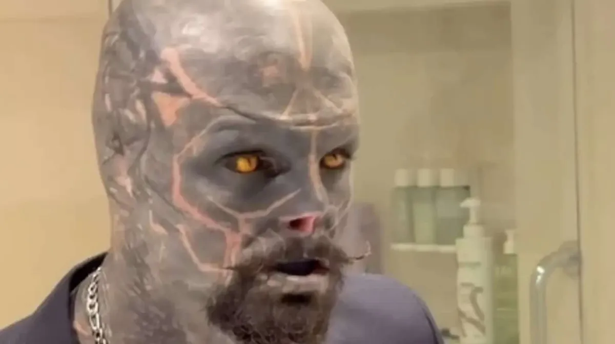 ‘Alien negro’ com modificações corporais extremas compartilh