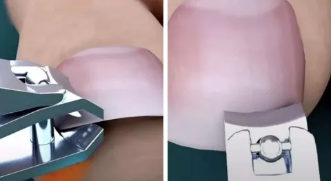 As pessoas estão descobrindo que estão cortando as unhas dos