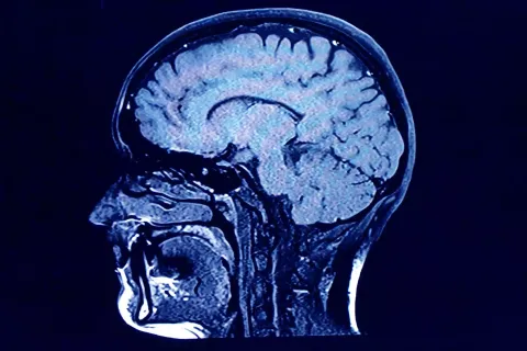 Cientistas gravam cérebro humano durante a morte e fazem uma