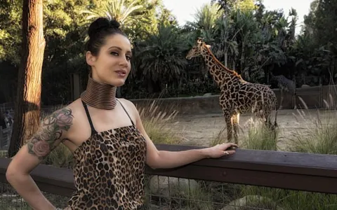 Como ficou a ‘mulher-girafa’, que passou 5 anos com anéis no pescoço?