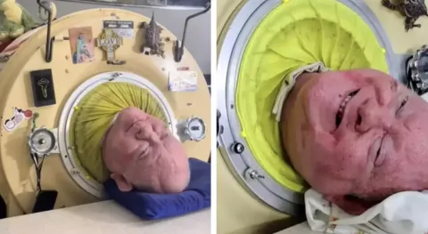 Como homem sobreviveu dentro de um “pulmão de aço” por 70 an