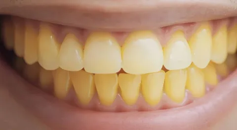 Dentista compartilha erro comum que muitas pessoas cometem e