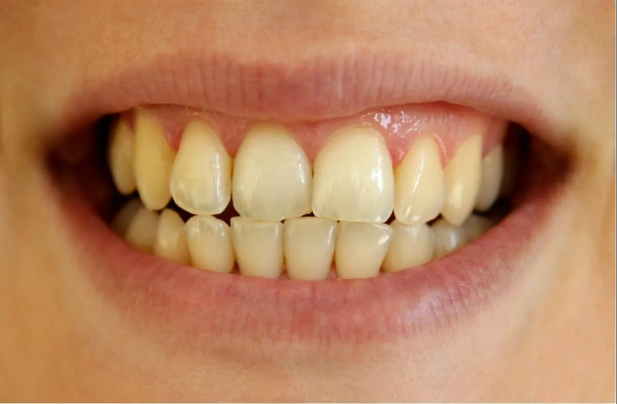 Dentista revela os 7 principais motivos pelos quais seus den