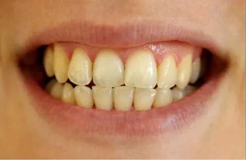 Dentista revela os 7 principais motivos pelos quais seus den