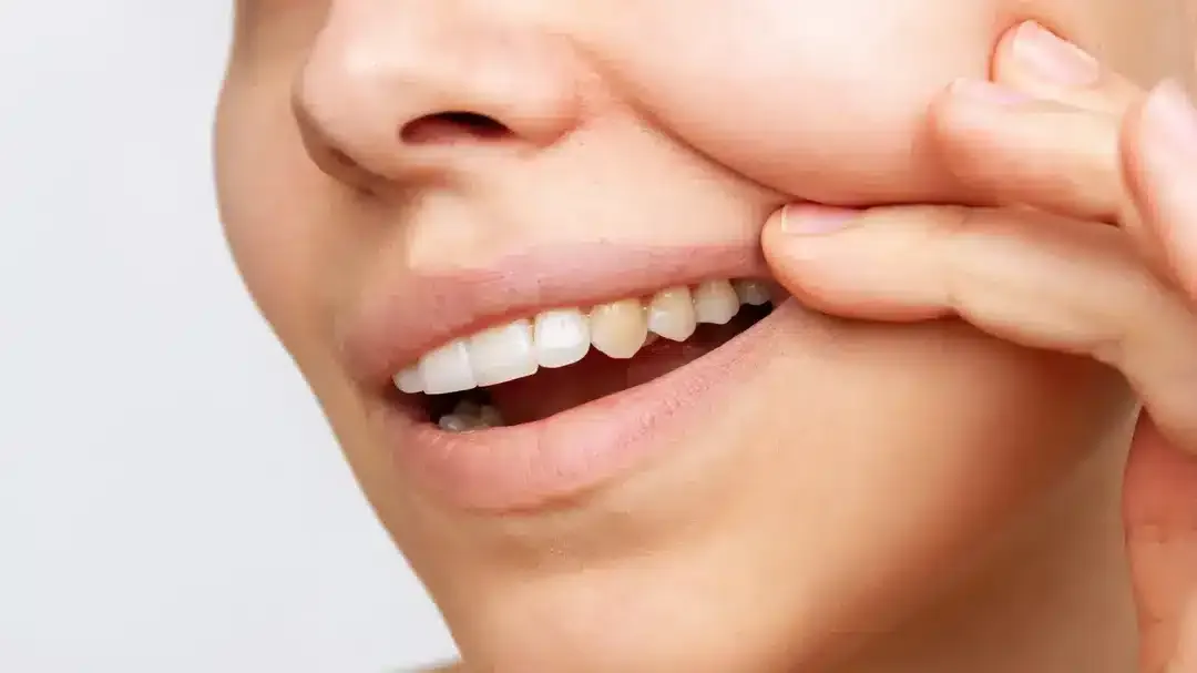 Dentista revela seis erros diários que as pessoas cometem e