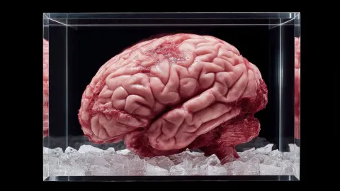 Descoberta fascinante: o que acontece no seu cérebro depois 