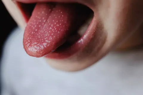 Especialista revela o que causa as “protuberâncias estranhas