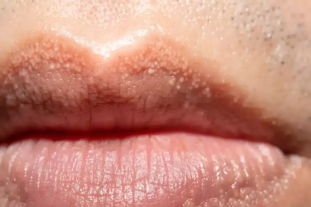 Especialistas emitem alerta sério para pessoas com séries de