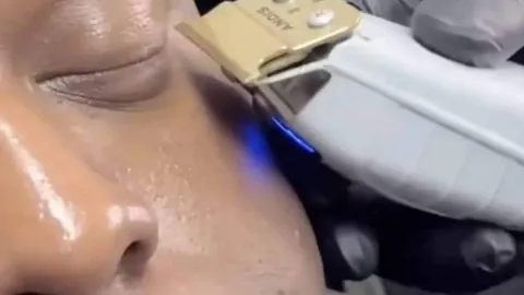 Especialistas emitem alerta sobre nova tendência ‘masculina’