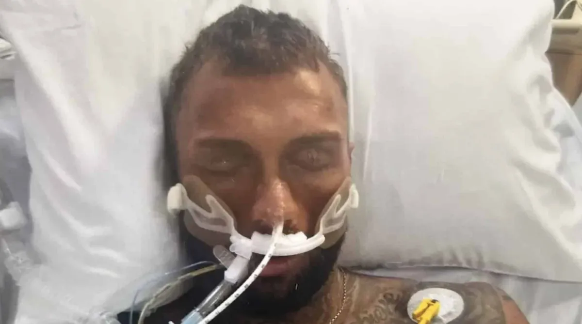 Fisiculturista de 32 anos luta pela vida após vício em reméd