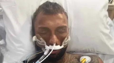Fisiculturista de 32 anos luta pela vida após vício em reméd