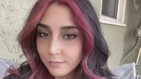 Funcionária de 24 anos, que ficou em morte cerebral após ger