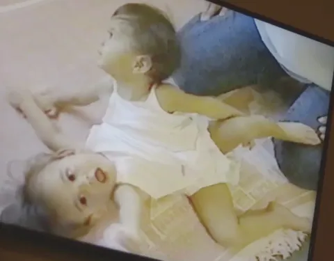 Gêmea siamesa revela o que acontece quando a irmã tem intimidade com o marido