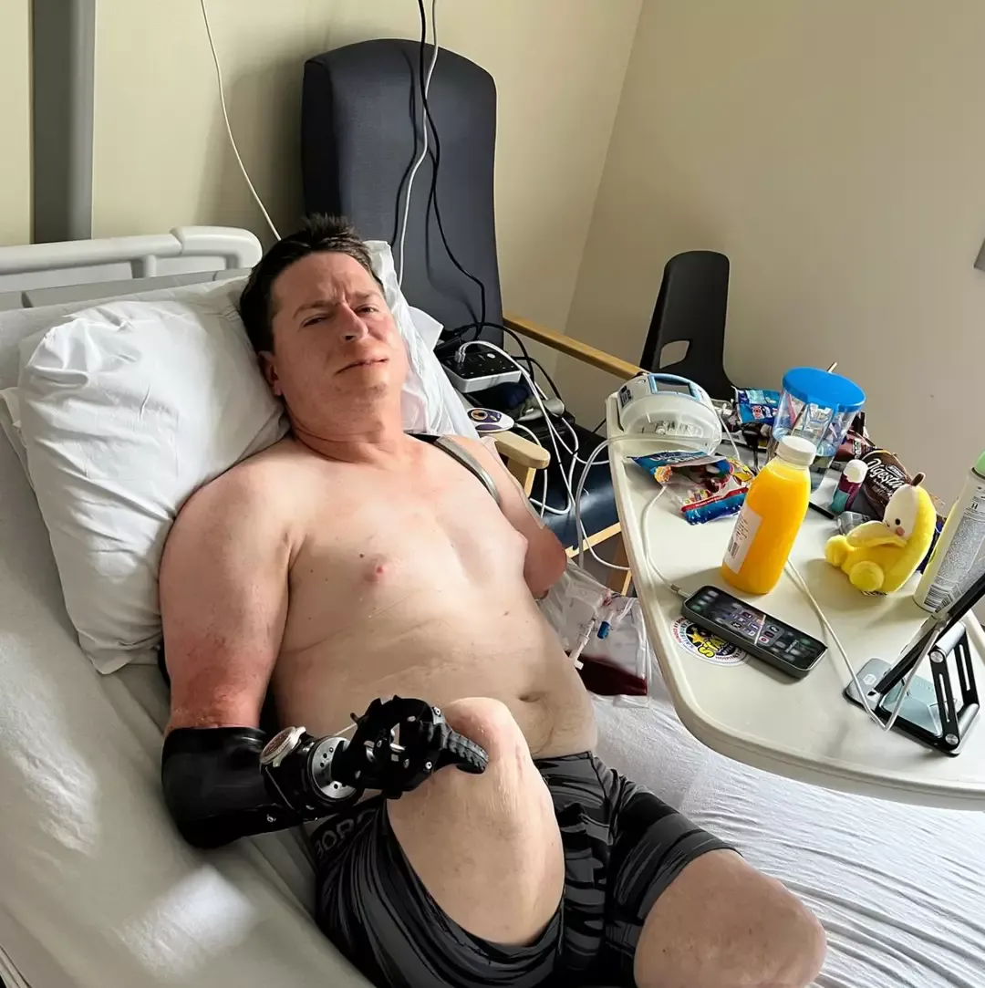 Homem achou que tinha sintomas de gripe, mas acabou precisan