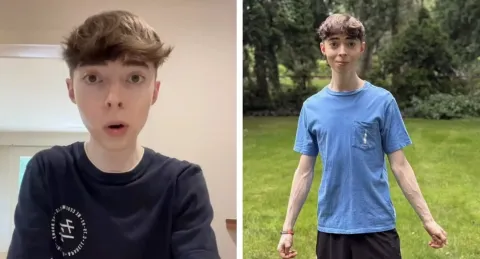 Homem com 35 anos parece ter 15. Como ele faz isso?