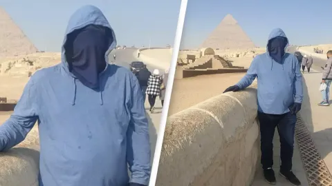 Homem com ‘doença do vampiro’ ultra-rara revela como é viver
