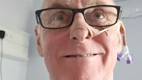 Homem diagnosticado com câncer de garganta ficou “surpreso” ao descobrir que foi causado por sexo oral