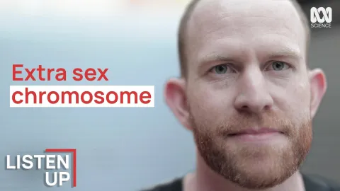 Homem diagnosticado com um cromossomo extra aos 31 anos reve