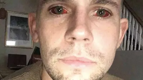 Homem faz alerta após maratona de 5 dias usando cocaína deix