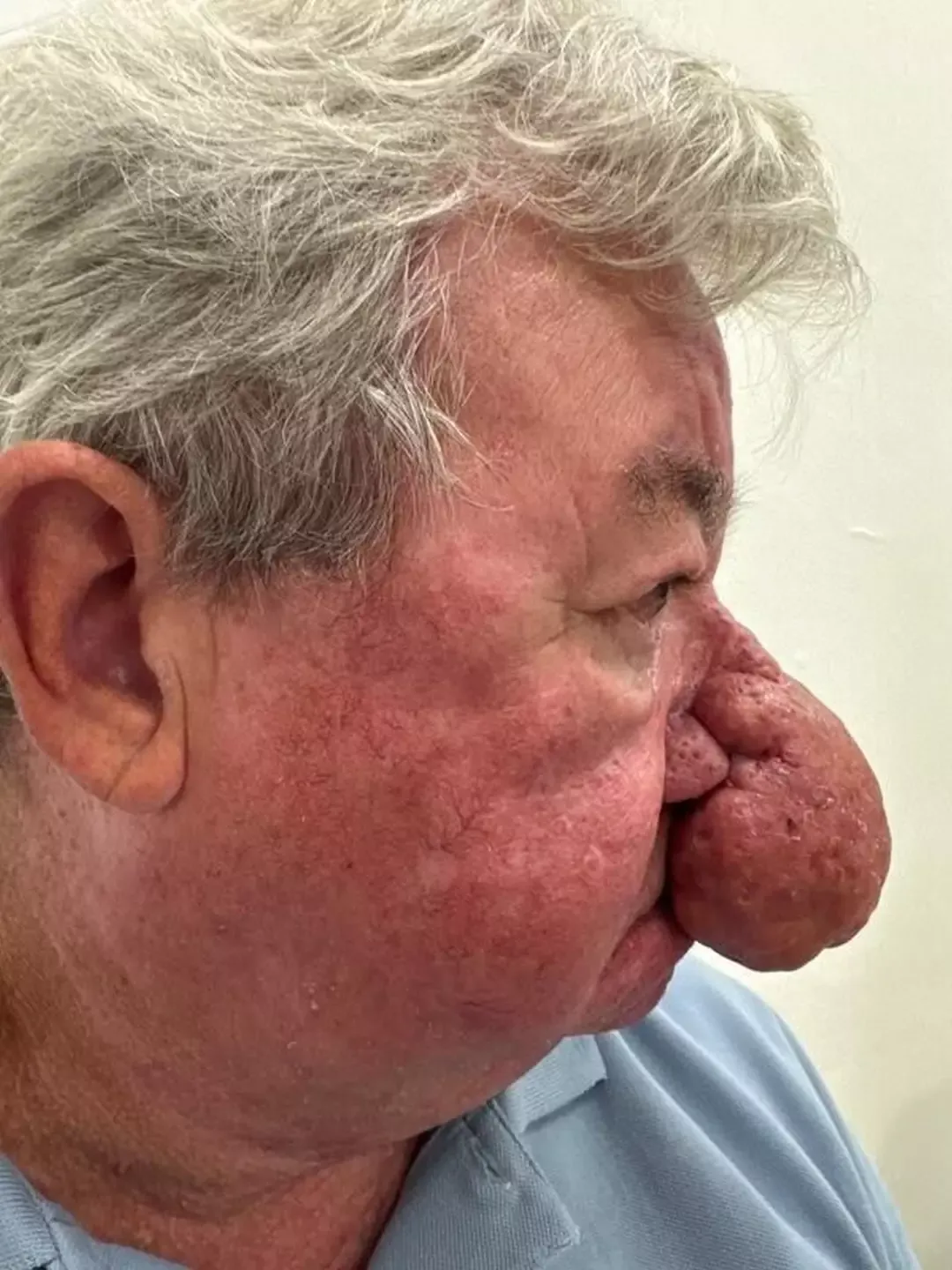 Homem fica incapaz de beijar a esposa após um dos piores cas