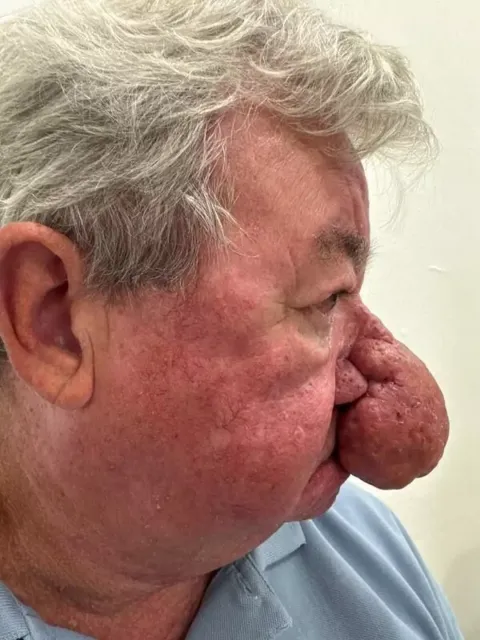 Homem fica incapaz de beijar a esposa após um dos piores cas