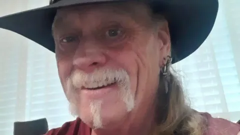 Homem que é um dos 75 no mundo que sofre de ‘síndrome da face demoníaca’ diz que a vida é como um ‘filme de terror’