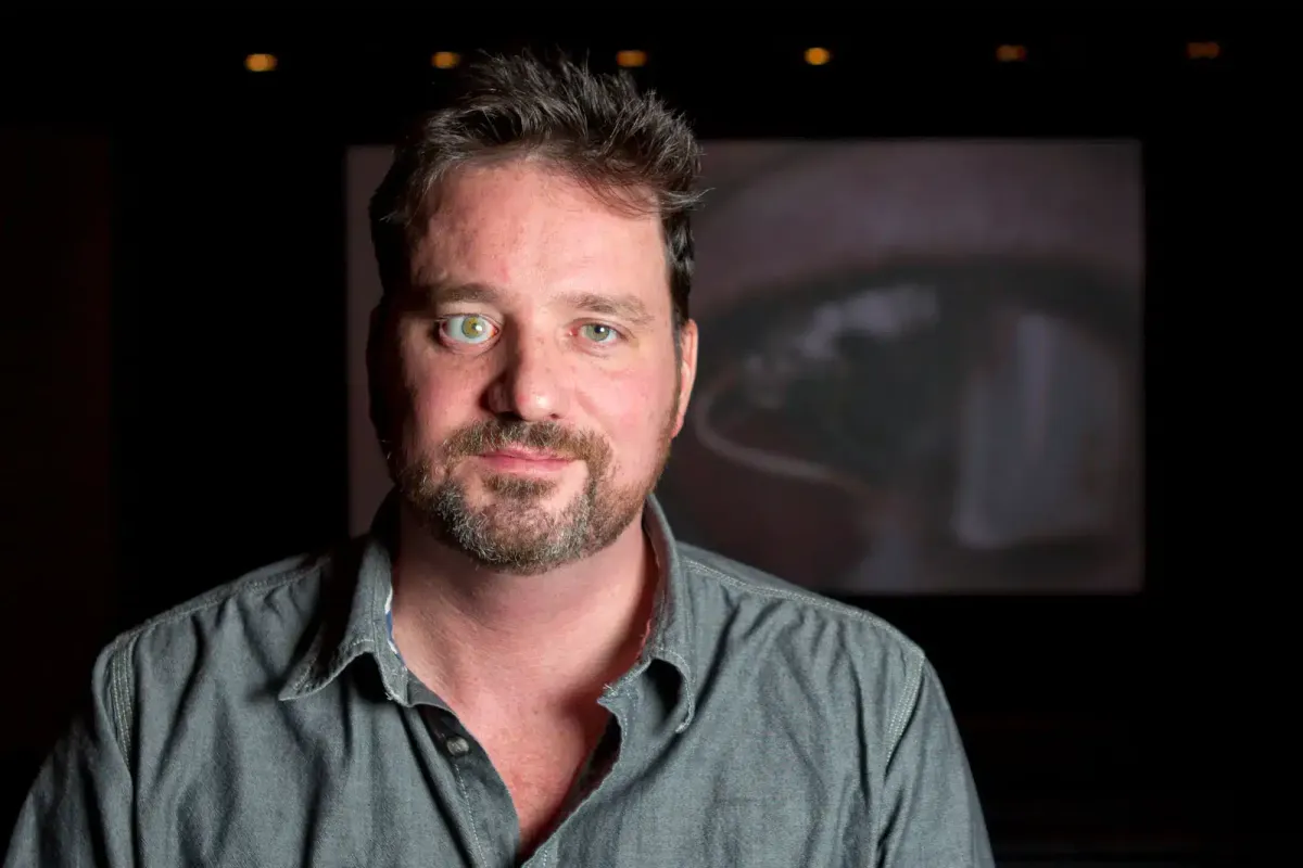 Homem que perdeu o olho explica por que o substituiu por uma