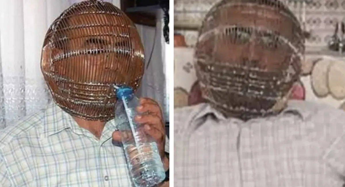 Homem que queria parar de fumar prendeu sua cabeça em uma ga