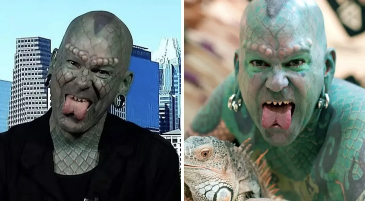 Homem que “se transformou em lagarto” revela os detalhes hor