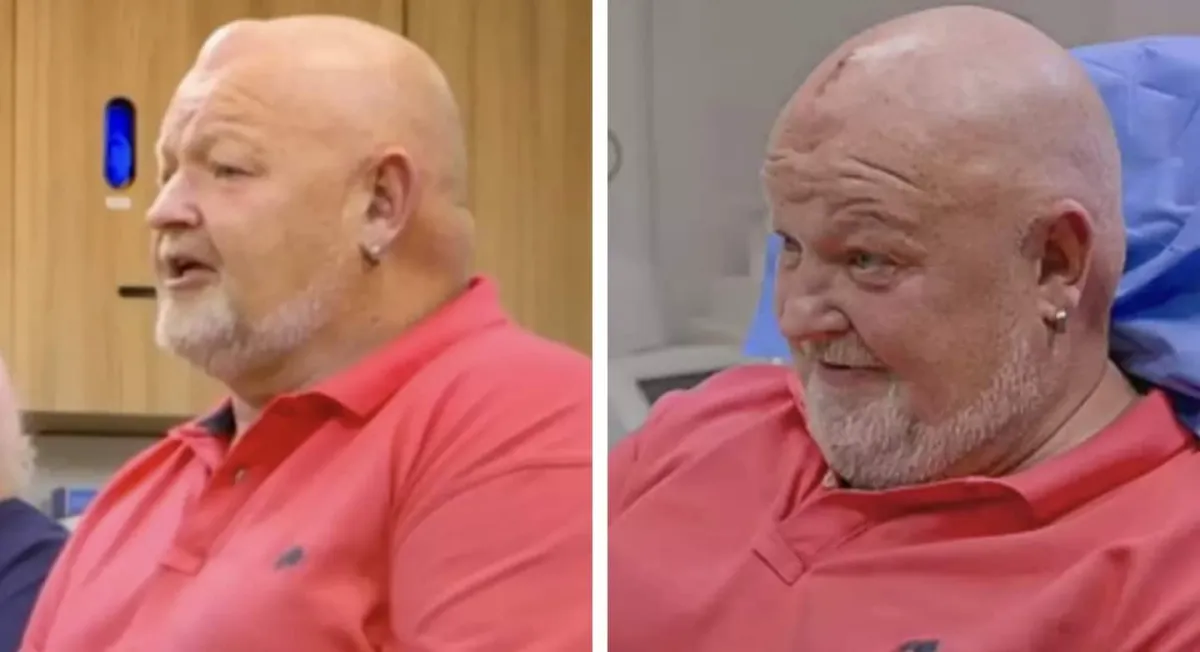 Homem que tinha caroço na cabeça há 30 anos após ser atingid