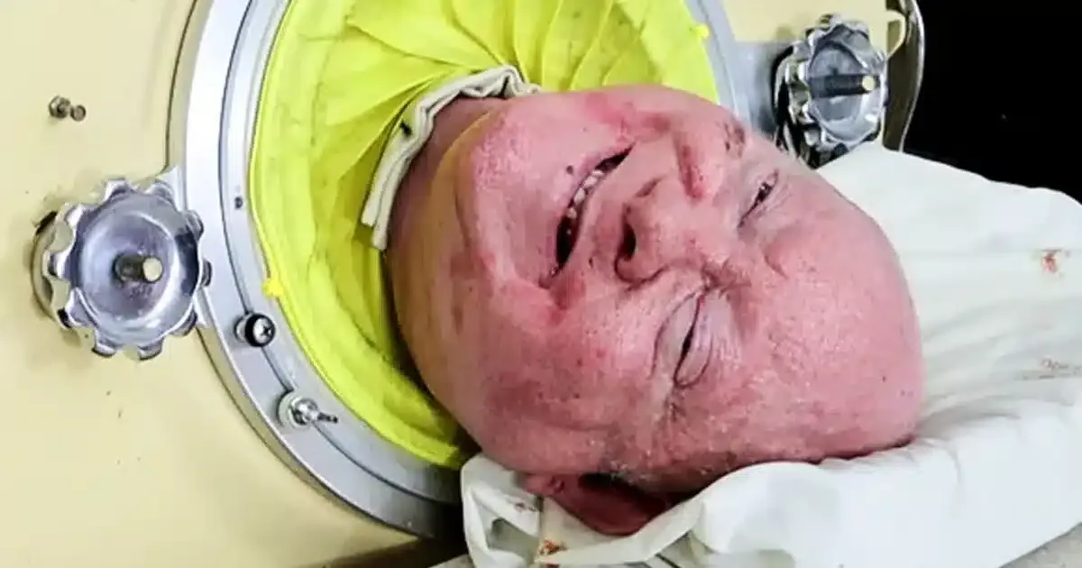 Homem que viveu dentro de um pulmão de ferro por mais de 70