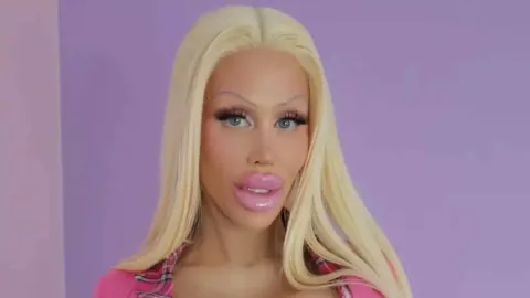 Imagem chocante mostra como era a mulher que gastou R$ 1,8 m