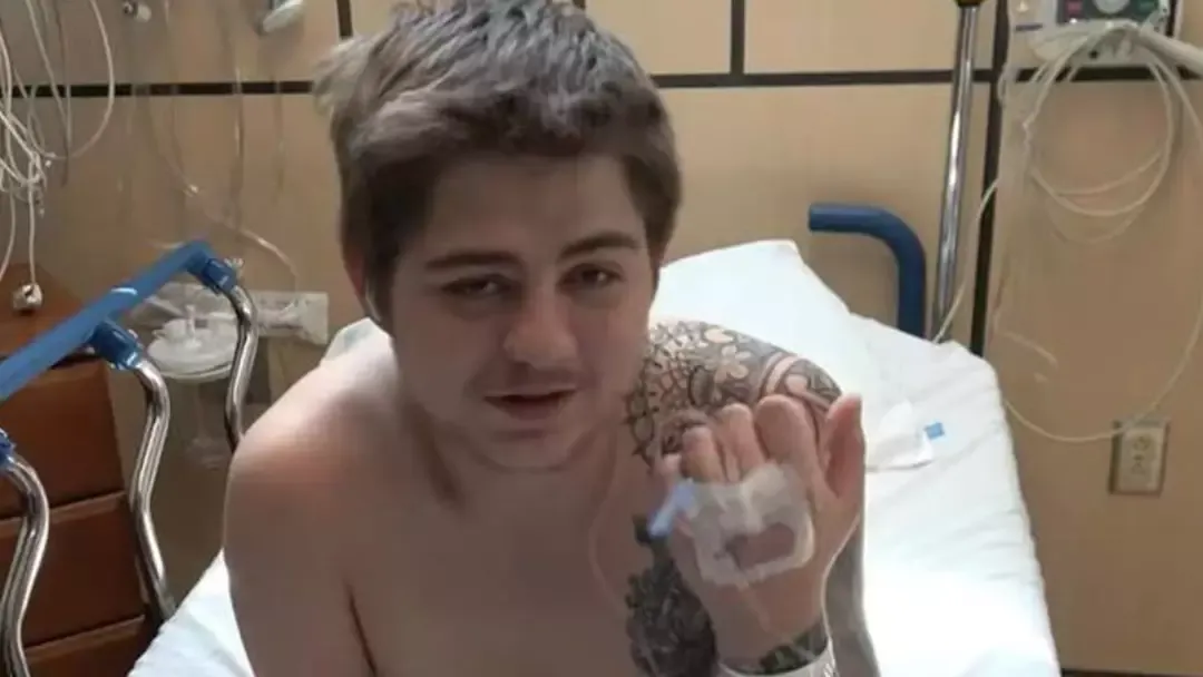 Jovem cortado ao meio por empilhadeira compartilha foto horr