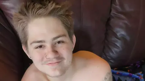 Jovem cortado ao meio por empilhadeira compartilhou foto imp