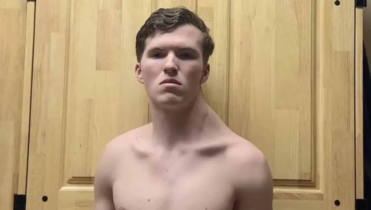 Jovem já treina há 182 dias apenas um lado do corpo, e os re