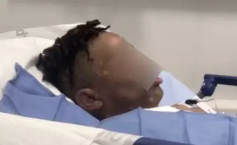 Jovens garotos enfrentam acusações após ‘jogarem água ferven