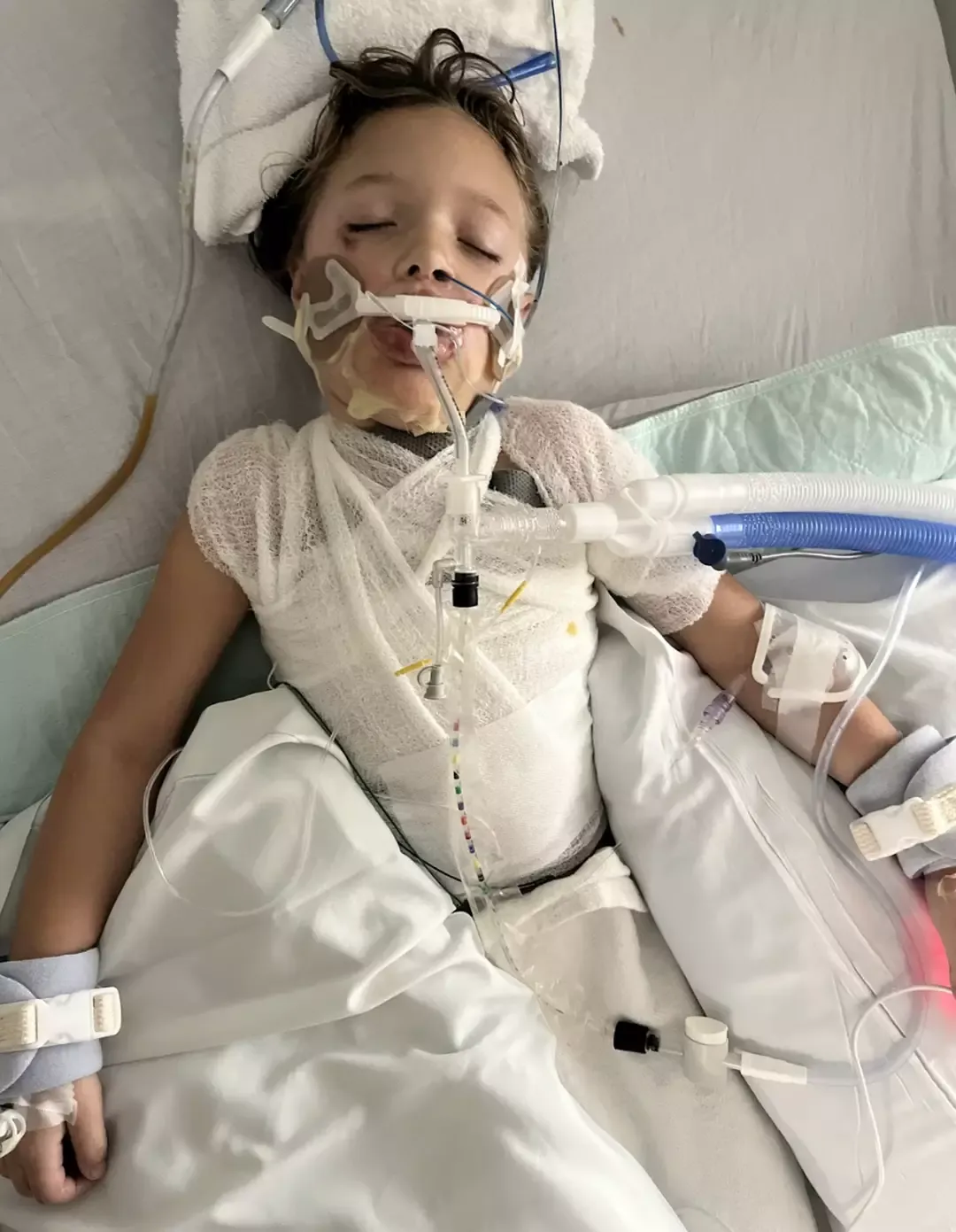 Menina de 7 anos fica em coma com ferimentos graves após bri