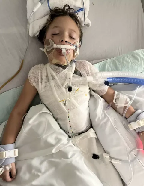 Menina de 7 anos fica em coma com ferimentos graves após bri