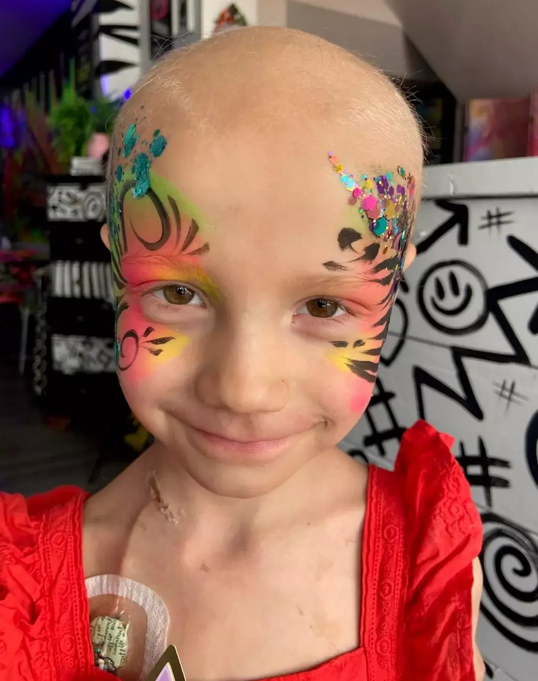 Menina de seis anos recebe apenas semanas de vida após uma “