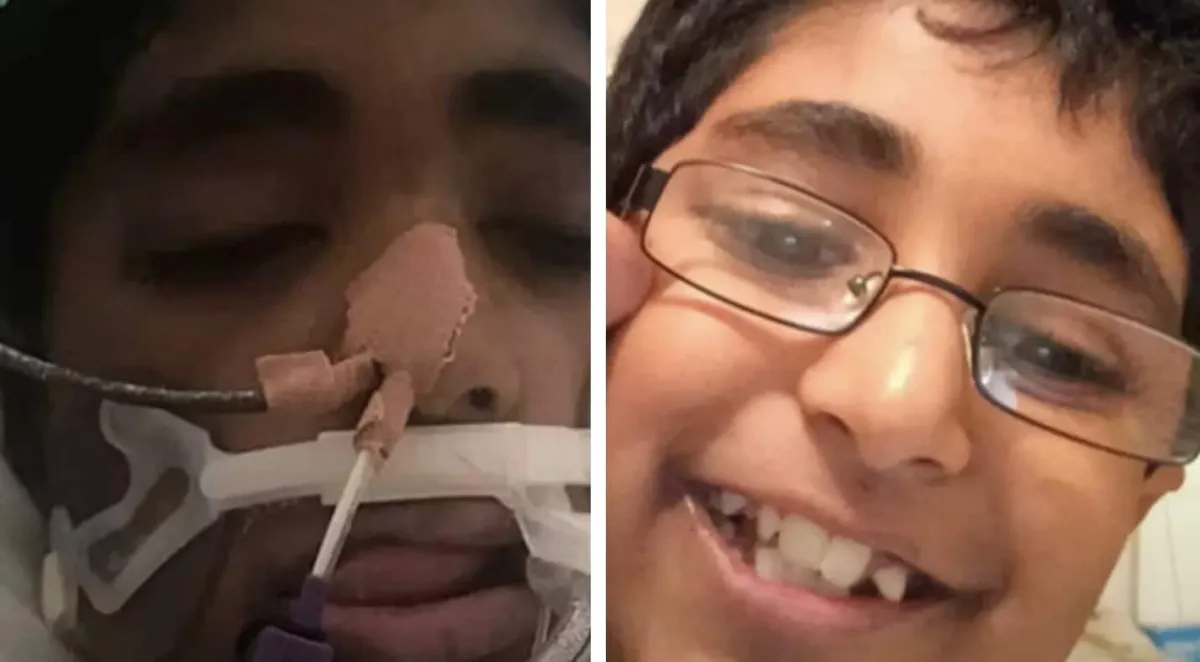 Menino de 13 anos com alergia grave morreu após ter um pedaç