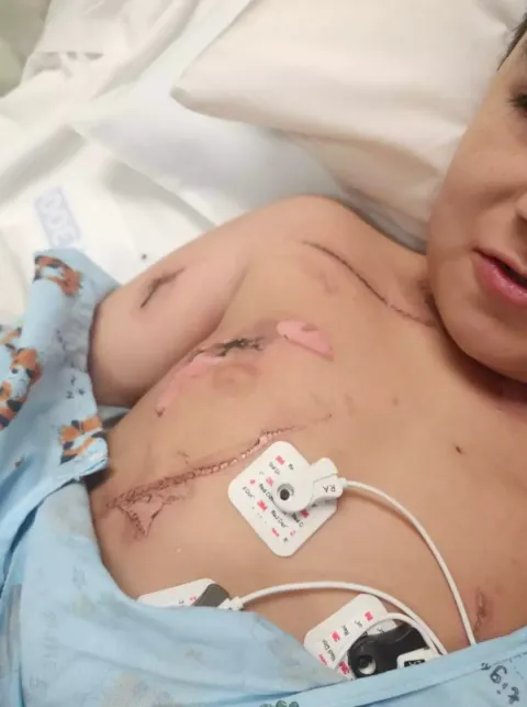 Menino de 8 anos achou que “ia morrer” após levar um choque 