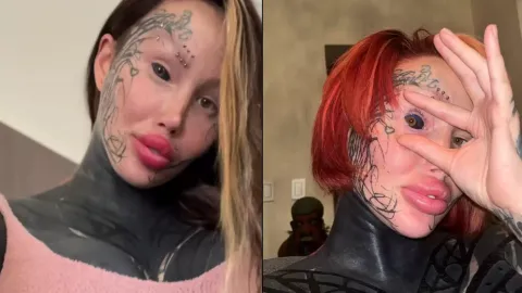 Modelo do OnlyFans que é ‘viciada em cirurgia plástica’ teve sua conta bloqueada após o último procedimento