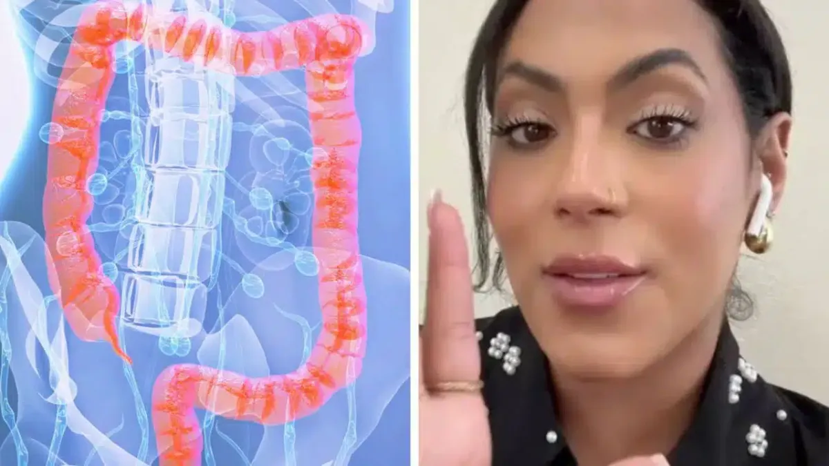Mulher diagnosticada com câncer de cólon revela os 5 sinais