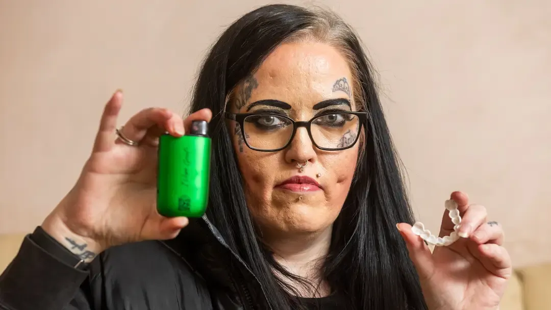 Mulher faz alerta após o vape deixá-la com “dentes pretos”