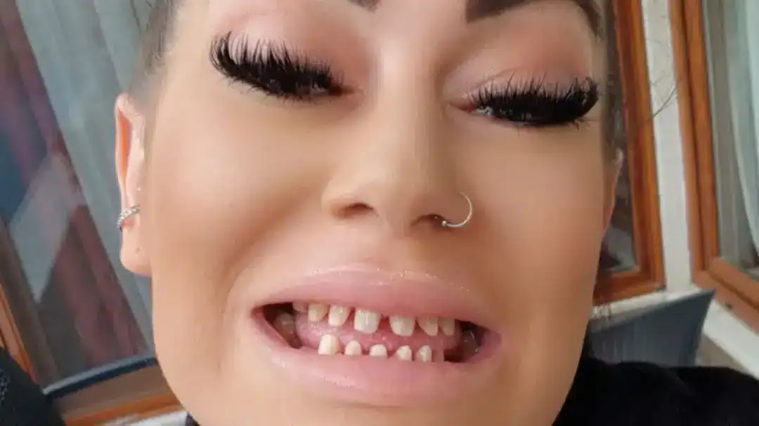 Mulher gastou R$ 120.000 em um procedimento dentário, mas fi