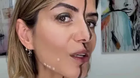 Mulher injeta apenas um lado do rosto para mostrar as difere