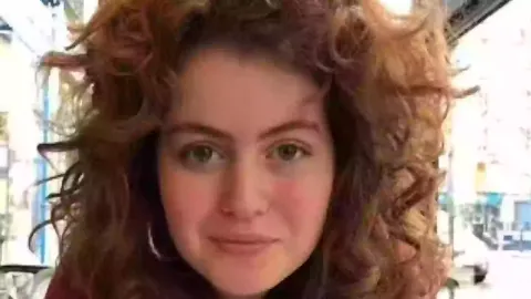 Mulher morreu com ‘sangue escorrendo dos olhos’ um dia após 